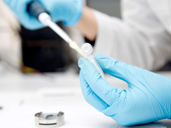 A close-up of hands in blue gloves holding a tissue sample vial and syringe in a lab setting